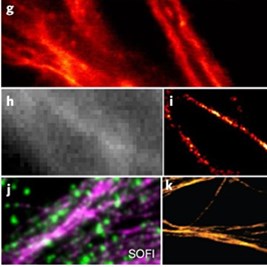 Nanoparticles shed light on the understanding of cellular malfunctions