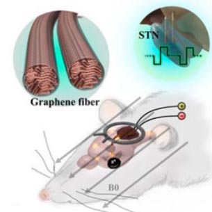 Important progress on the MRI compatible DBS electrodes and simultaneous DBS-fMRI 